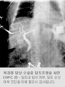 복강경 담낭 수술중 담도조영술 사진(OPC 2) - 담도내 담석 여부, 담도 손상여부 진단을 위해 필요시 검사합니다.